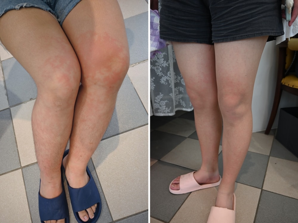 台中蒸足推薦|恩堤蒸足屋體驗,幫助代謝更健康,超夯足蒸養生保健法 - 第26張圖 台中蒸足推薦|恩堤蒸足屋體驗,幫助代謝更健康,超夯足蒸養生保健法